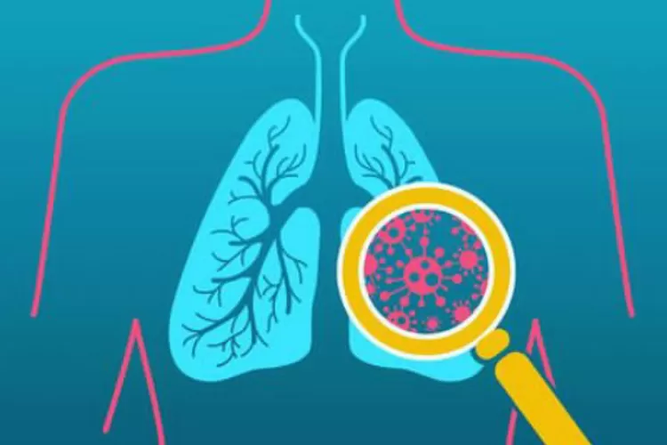 Gejala Mycoplasma Pneumonia Beda Dari COVID-19