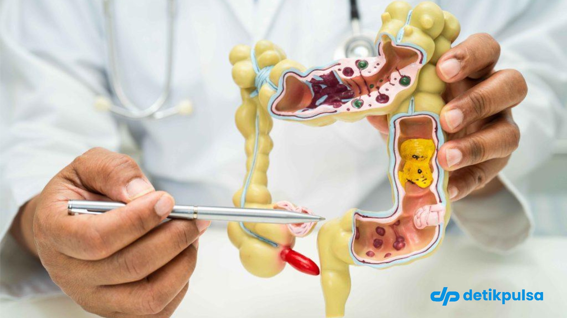 5 Gejala Kanker Usus Besar pada GenZ yang Sering Diabaikan